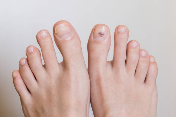 Foot Health